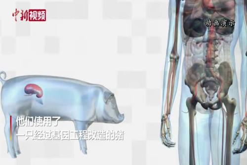 纽约警方通缉抢劫华裔妇女嫌犯闹乌龙吁民众助抓真凶-中新网