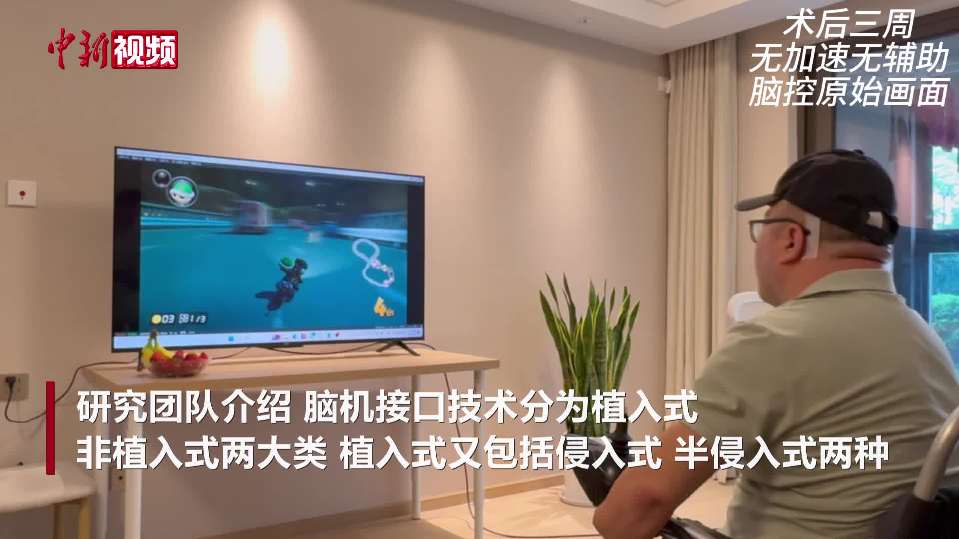 创造三项世界之最 中国侵入式脑机接口进入临床试验阶段